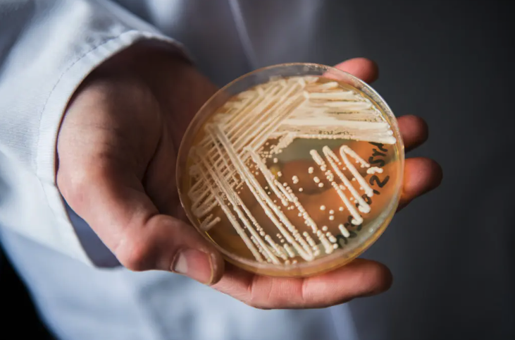 Deadly Candida Auris Fungus Spreading at 'Alarming Rate' in the US, Says CDC