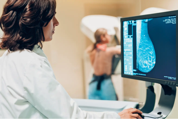 US Panel: Breast Cancer Screenings Should Begin at 40