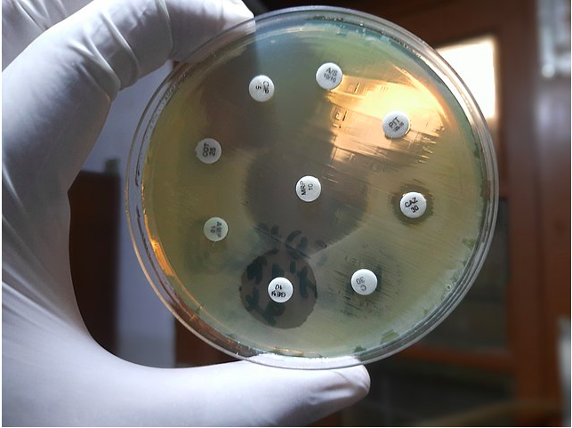 New Superbug-Killing Antibiotic Discovered Using AI